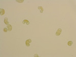 MISSING THUMBNAIL